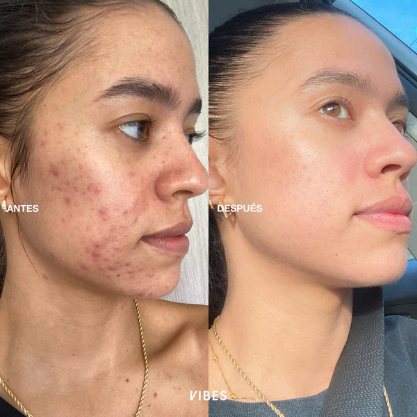 SERUM CONTROL GRASA 35G VIBES