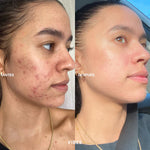 SERUM CONTROL GRASA 35G VIBES